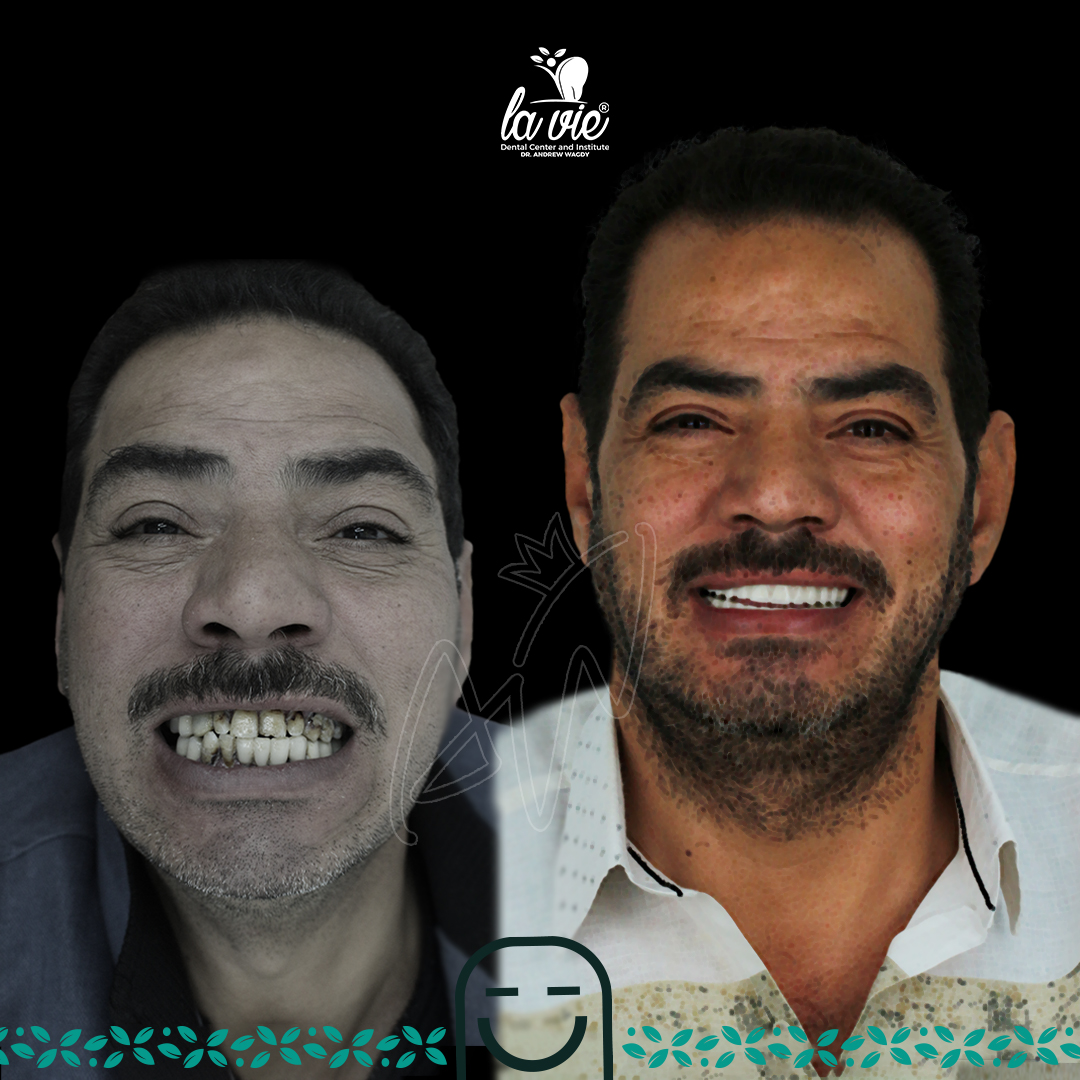 6869393595652_drbbzq